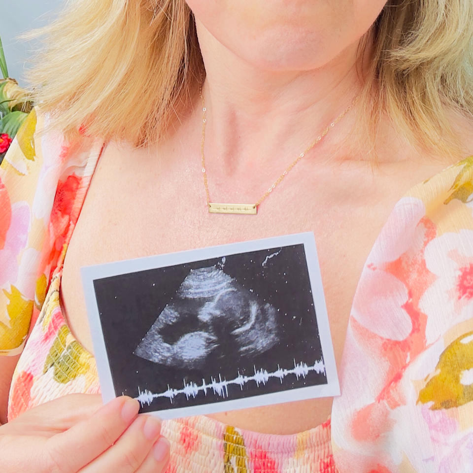 A mom wearing a gold engraved heartbeat necklace holds up a photo of her babys ultrasound and sonogram. Each necklace is crafted with sentimentality and care in mind, and can be created with your personalized photograph. Gift for New Mom